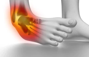 Làm Gì Khi Bị Lật Sơ Mi Cổ Chân Cùng Keovip.blog